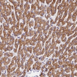 DBC1 Antibody, Novus Biologicals:Antibodies:Primary Antibodies